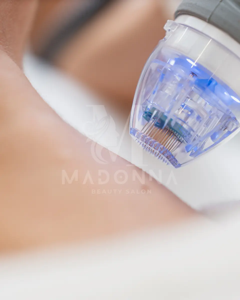 Microneedling Ear Piercing