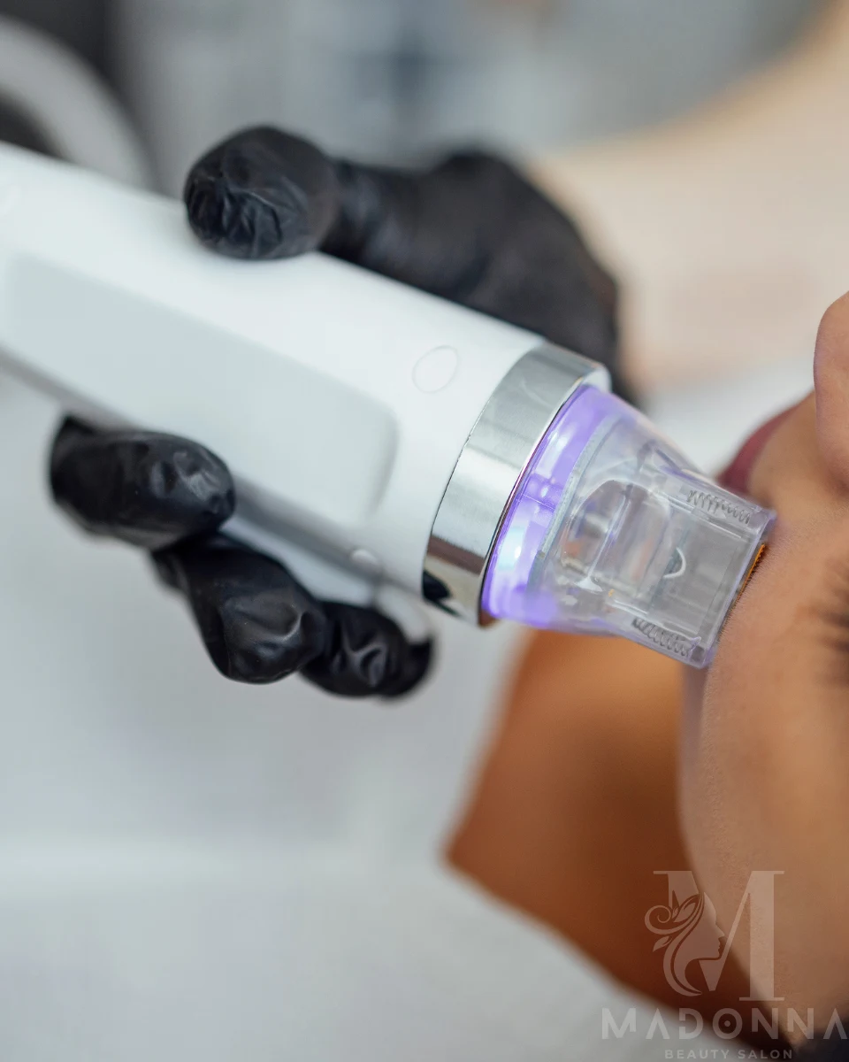 facial-treatments-microneedling A woman combs her hair, showcasing her fresh haircut in a bright, well-lit room.